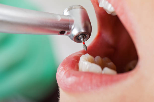 Best Emergency Dental Care for Trauma or Injury in Summerset, SD